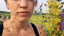 俄罗斯网红自拍满脸蚊子照展现夏季煎熬