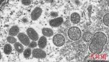 世卫组织称欧洲构成猴痘疫情中心 过去两周病例增加两倍