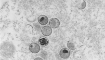 美国猴痘确诊病例超1800例 前高官批美未能控制疫情暴发